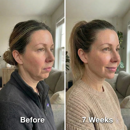 Collagen Face Sculpt Wrap [FREE TODAY]